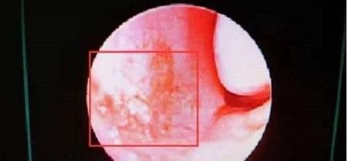 4岁男孩鼻血不止,送医院被告知“无法抢救”,只因宝妈这一举动