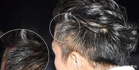 脱发的问题|白发多别着急拔,洗头时加上“它”,白发悄悄黑回来,还能防脱发