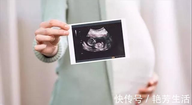 双胞胎|孕妇肚子的形状、大小、高低，代表了不同含义，准妈妈知道多少