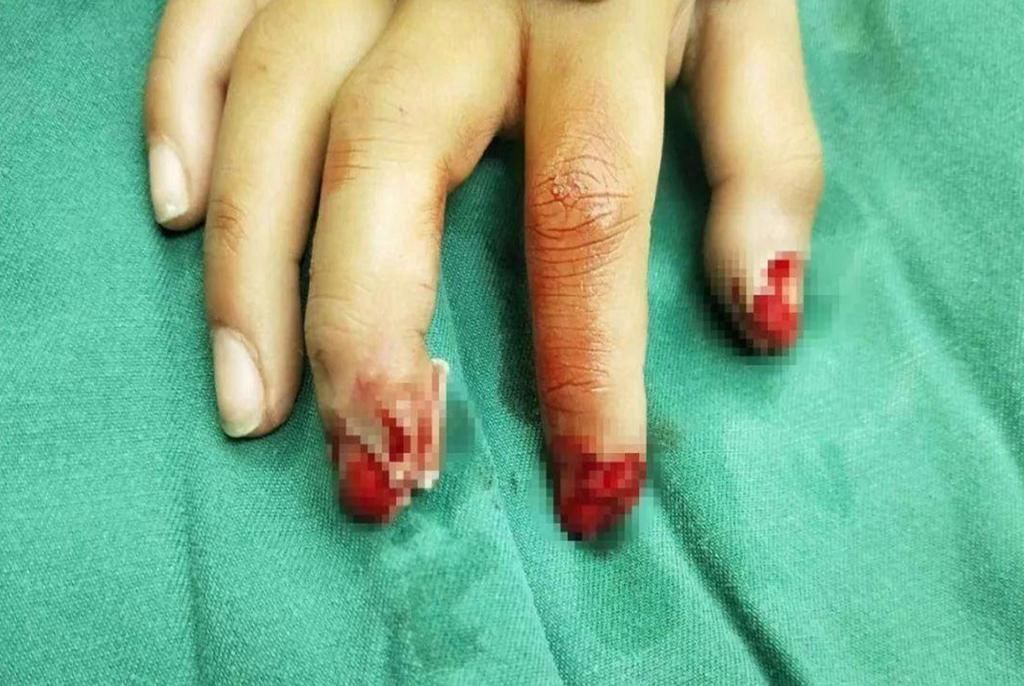 受伤|母亲“生产痛”高达十二级,孩子的“忍痛超能力”竟也超乎想象