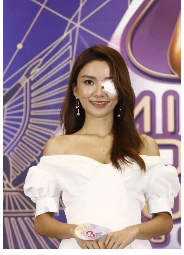 紗布|突然生眼挑針！3號候選佳麗以“獨眼龍”形象示人，擔心影響奪冠