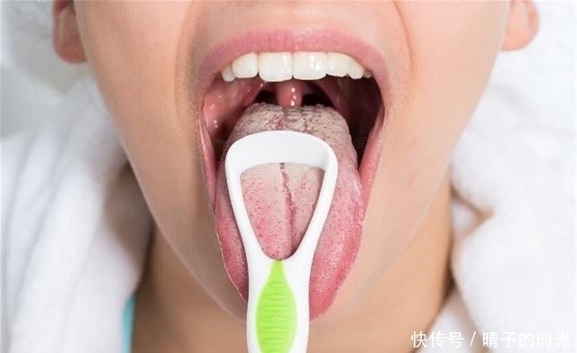  胡萝卜|失眠多梦肝火旺！4样食物是肝脏“灭火器”，排肝毒，平肝火