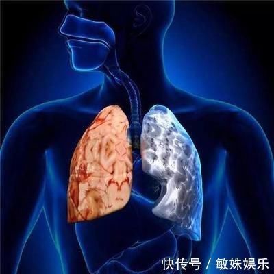 红润|48岁大哥喝酒26年,肝脏依然健康红润,医生:幸好坚持酒后3件事