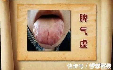 黄芪|人虚生百病,气虚、肺虚、脾虚,4味中药补虚不上火,身体更健康