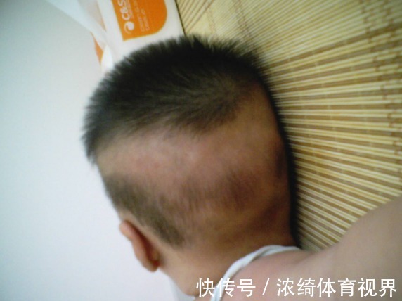 误区|别动不动就说“宝宝缺钙”,五个表现并非缺钙,你“误补”过几个