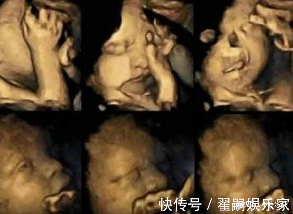 流产|7个月孕妈去产检,发现胎儿“捂鼻子”,了解情况后医生怒斥孕妈