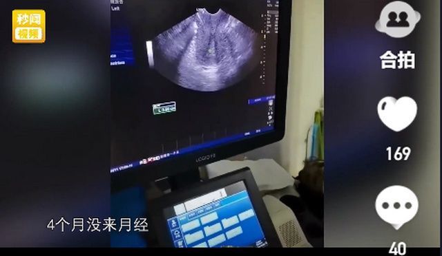 月经不调|37岁女子想怀孕,医生检查后无奈叹息:你要是早一点认识我就好了!