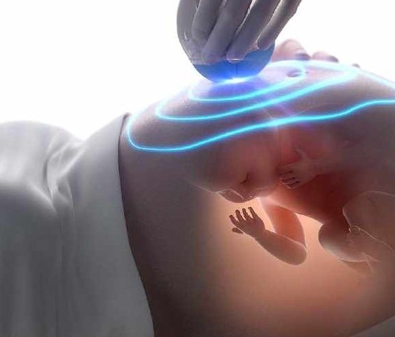 胎检|正常胎检为什么生下“畸形儿”？可能和这3个原因有关，不妨一看