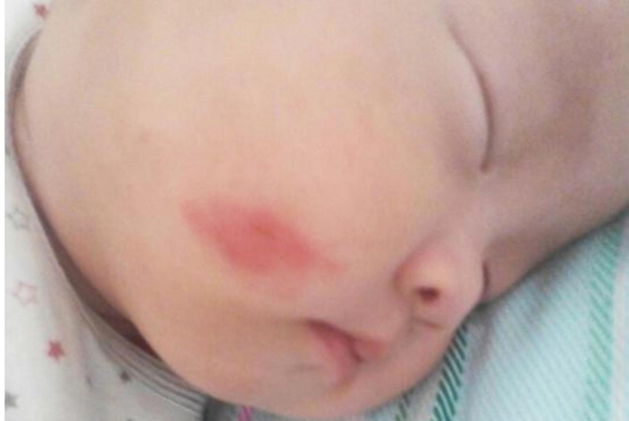 产道|“不要用产钳,再让我试试”产妇的一句恳求,为孩子绕开产钳之痛