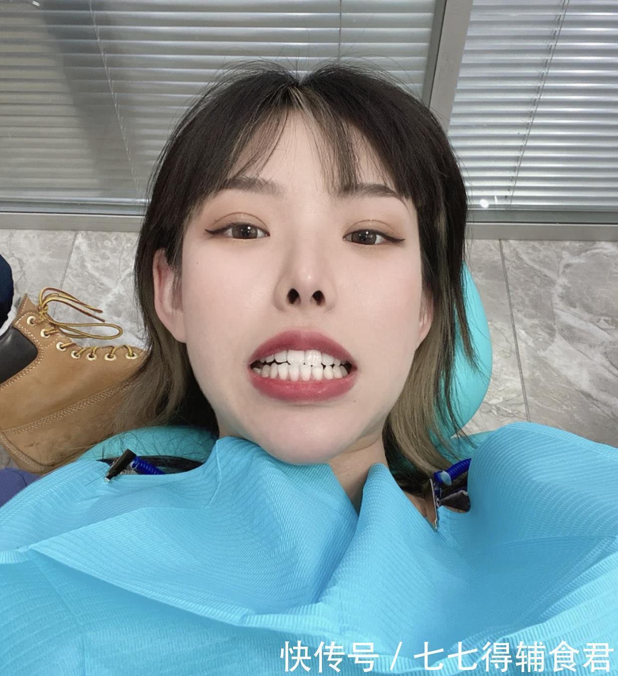 嘴巴|长期涂口红的女生,嘴巴都成什么样了?看3点就很明显