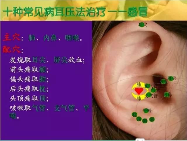  交感|十种常见病耳穴疗法