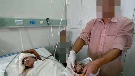 妈妈|剖腹产后没多久,肚子竟还是大如球,医生再次手术时也惊出一身汗