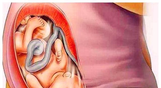 暴涨期|胎儿在宫内是如何发育成型的?十张图读懂胎儿发育过程,都该看看