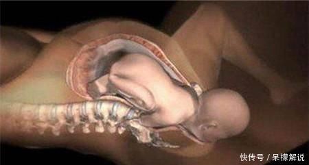 胎儿|胎儿入盆代表你快要卸货了原来做这个小动作能促进胎儿尽早入盆