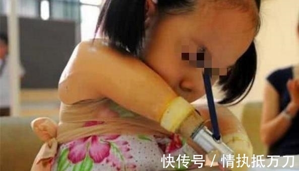 伊利斯|2岁女童看起来像80岁,病情独特全球首例,网友:希望返老还童