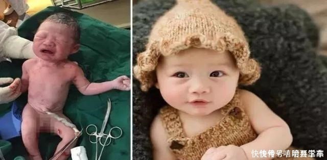 美成天使|被刚出生的宝宝丑哭千万别扔,组图告诉你三个月后颜值美成天使!