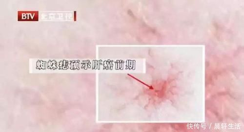 “养肝高手”找到了,不是胡萝卜,每天泡水喝两杯,给肝脏洗洗澡