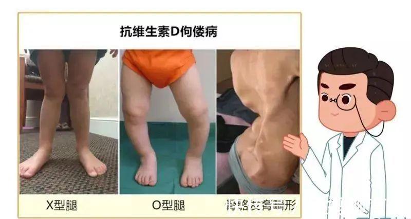 遗传病|这几类夫妻,生二胎要谨慎