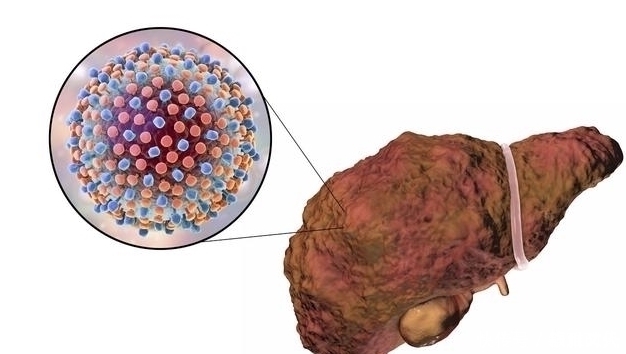 决明子|身体这4个表现说明“肝毒深”,3个养肝法,每天花2分钟护肝