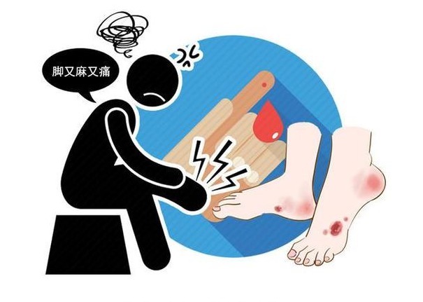保养|脚是肾脏的晴雨表!脚上出现4个异常,可能肾脏需要保养了