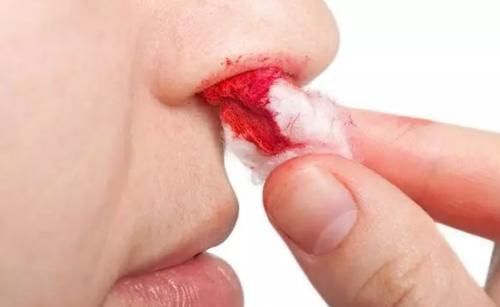 蕨菜|28岁女子养生养出肝硬化？忠告：不想肝功衰竭，3种蔬菜立即撤下餐桌