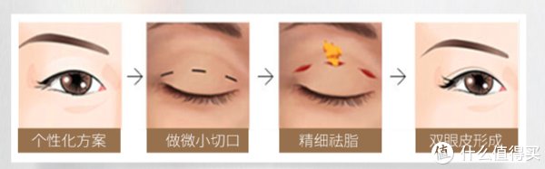 13年前做的双眼皮到现在还好吗？双眼皮带给我的变化