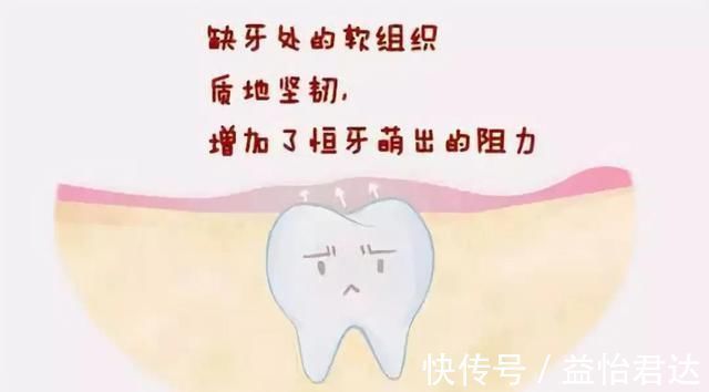 牙齿|孩子12岁前必须处理的牙齿问题!家长都了解吗?