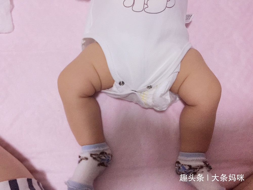 妈妈|腿部可以看出健康问题,宝宝双腿出现3种情况,妈妈不能小觑