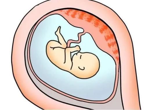 胎盘|生娃后胎盘该如何处理?“埋”还是“吃”?医生:不要盲目处理