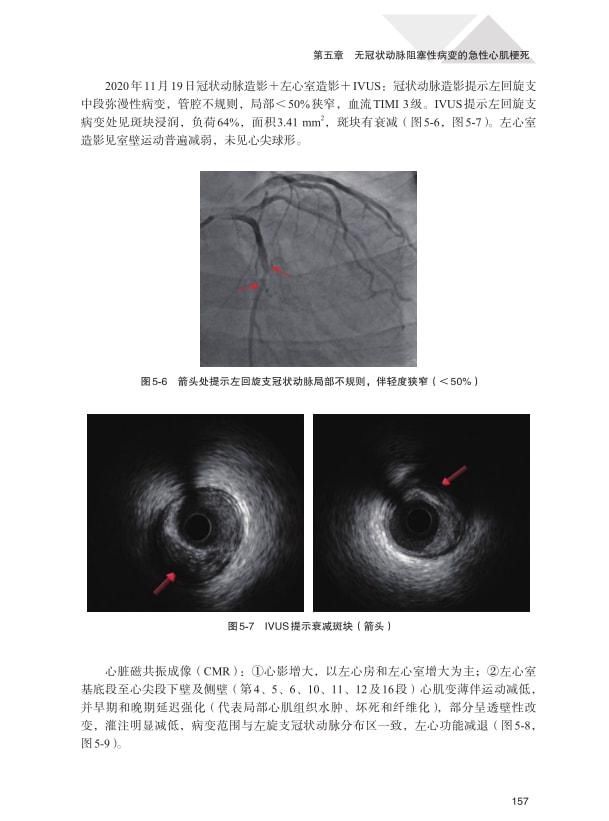 点评|凝聚经验和心血：《心血管精选病例及点评》