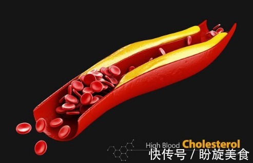 食物|甘油三酯偏高怎么办饮食上注意3少4多,助你有效降血脂