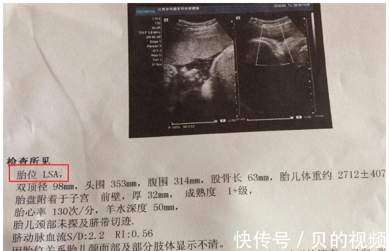 孕妇|到了这个孕周,胎儿“胎位”基本固定,以后再纠正就难了