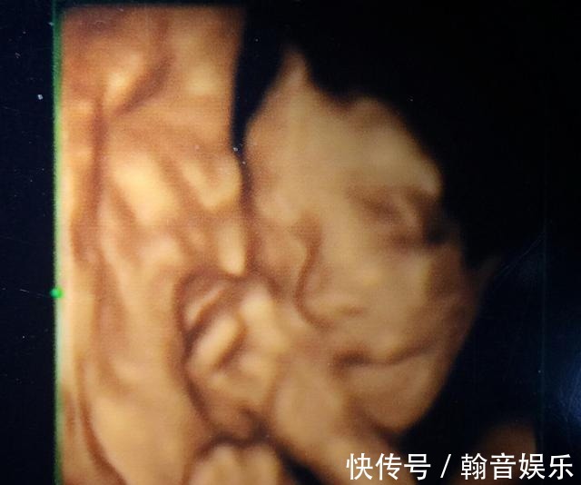 误区|孕期要做四维彩超,四维彩超的这些误区和认识,孕妈妈早知道早好