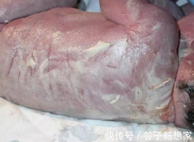 怀胎|怀胎11个月产下“牛奶宝宝”,全家紧张万分,护士恭喜宝妈