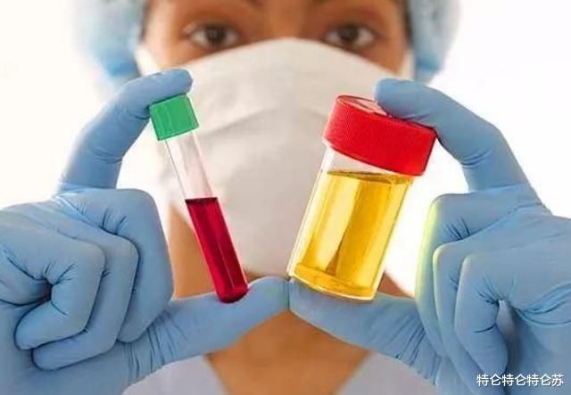 尿酸偏高的人，建议少吃1类食物，常喝“1茶”，或助尿酸值平稳