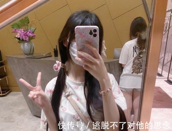 脱发 蔡萝莉真的是一姐?出现秃头危机后,花10多万植发