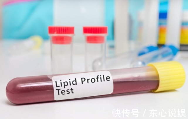 血脂|大鱼大肉并非高血脂“根源”,这3物才是,劝你管住嘴,莫贪吃