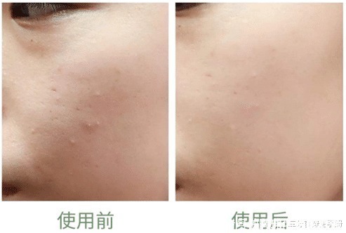 口红|买家秀与卖家秀“区别太大”,不是因为你没模特的五官,而是皮肤