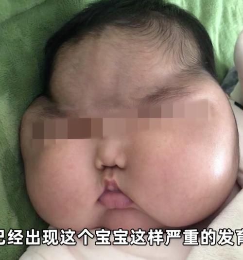 大v|“大头娃娃”再次出现，额头长满汗毛，这次是“毒护肤霜”惹的祸