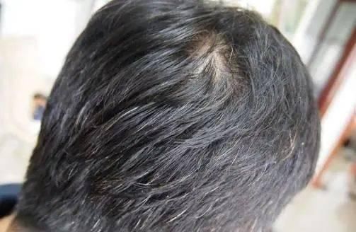 人们多少岁才开始长白发若你晚于这个年纪,说明保养得很好