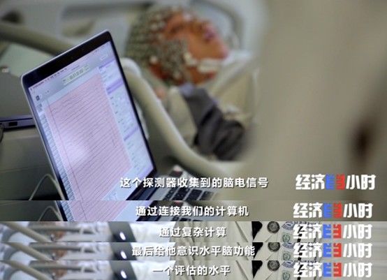 患者|现实版“读脑术”来了！把你的脑电波变成语言