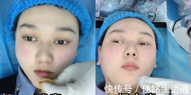 水光 医美干货分享水光针适合你吗!