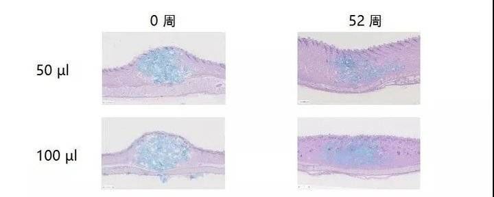 玻尿酸|7.3戴霞博士携手瑞蓝新品丽瑅·丽多为您精雕高定容颜