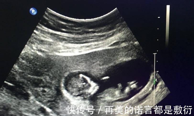 男孩|怀孕后,想知道胎儿性别是什么,可以尝试这些方法来鉴别