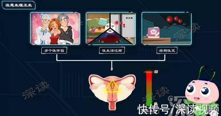 病原體|性生活過頻、人流手術會引發盆腔炎？生活中哪些事易招惹盆腔炎？