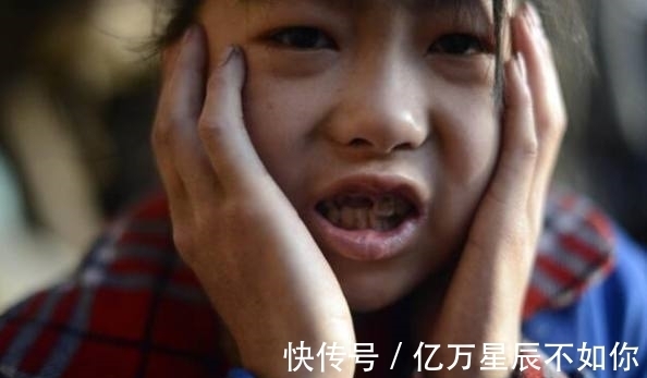 医生|女孩如今每天吃八顿饭,十几斤大米,医生检查后却这样说