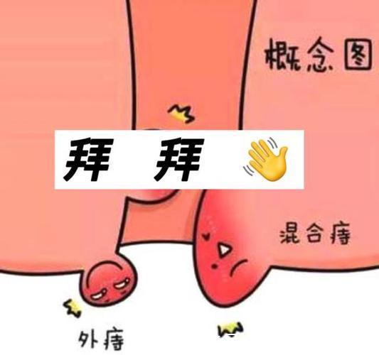 肉球|痔疮肉球不痛不痒可以不管吗？老中医：不可！每天做好这些，痔疮肉球慢慢缩回去！