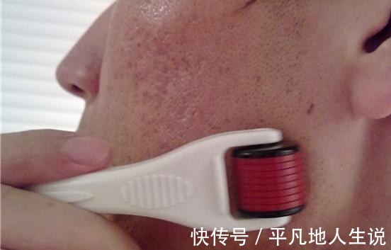 医美 皮肤不好,做医美真的能把皮肤做好吗!