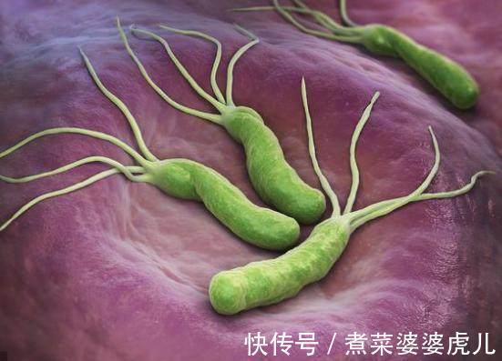 打嗝|发现胃胀、打嗝、有幽门螺杆菌怎么办?中医3小妙方,方法很简单