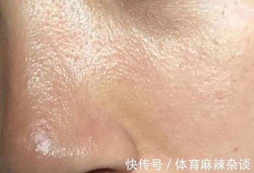 烟酰胺 脸上“又油又干”到底该如何选择护肤品